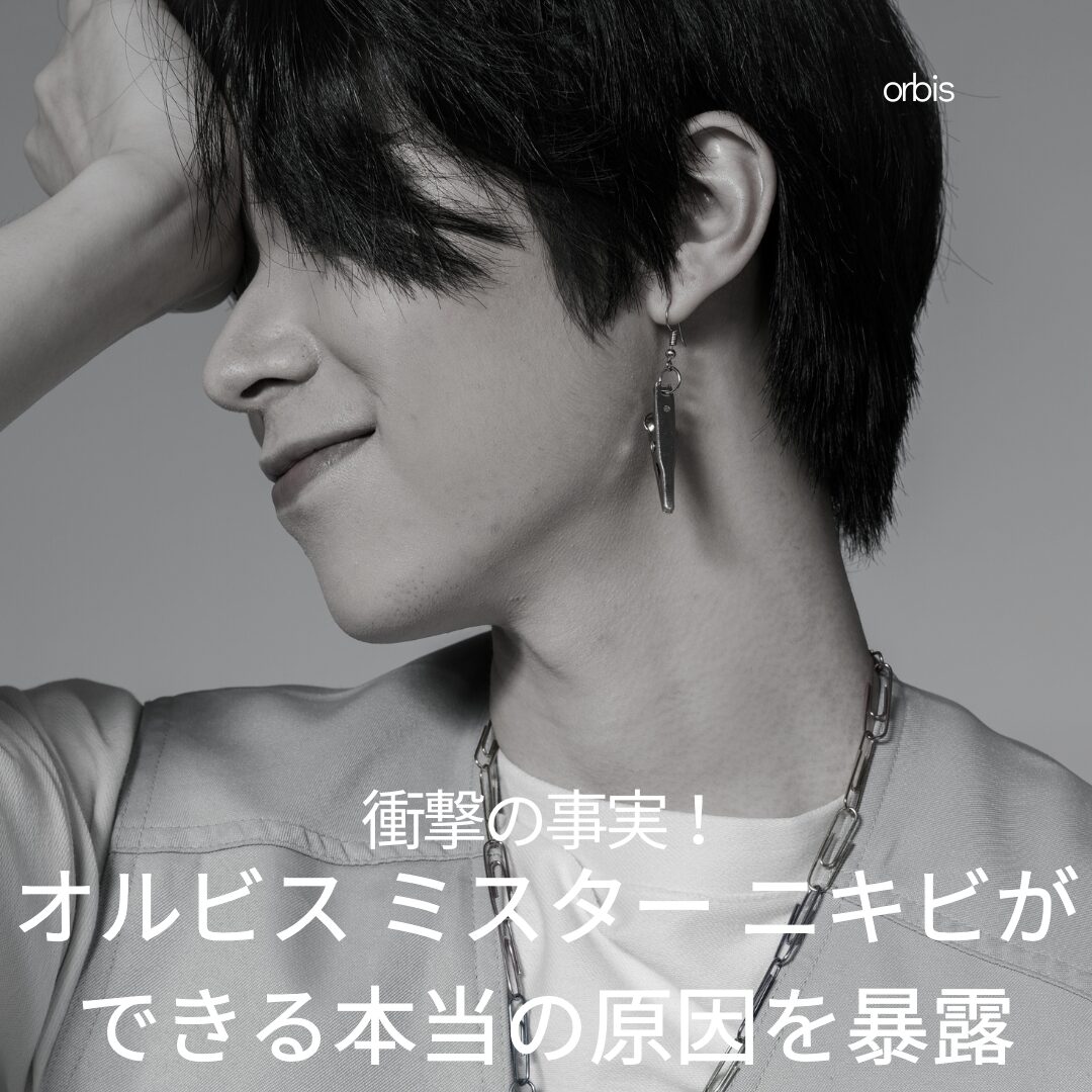衝撃の事実！オルビス ミスター ニキビができる本当の原因を暴露
